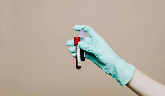 Adon Health_Kapillarbluttest_Testosteron messen_Hand hält ein Röhrchen mit Blut für einen Testosterontest