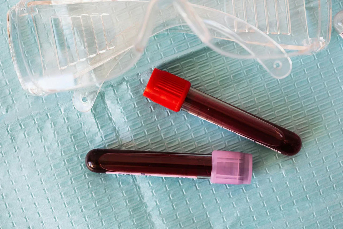 Zwei mit Blut gefüllte Probenröhrchen mit farbigen Verschlüssen (rot und lila) liegen auf einer medizinischen Unterlage, daneben eine Schutzbrille.