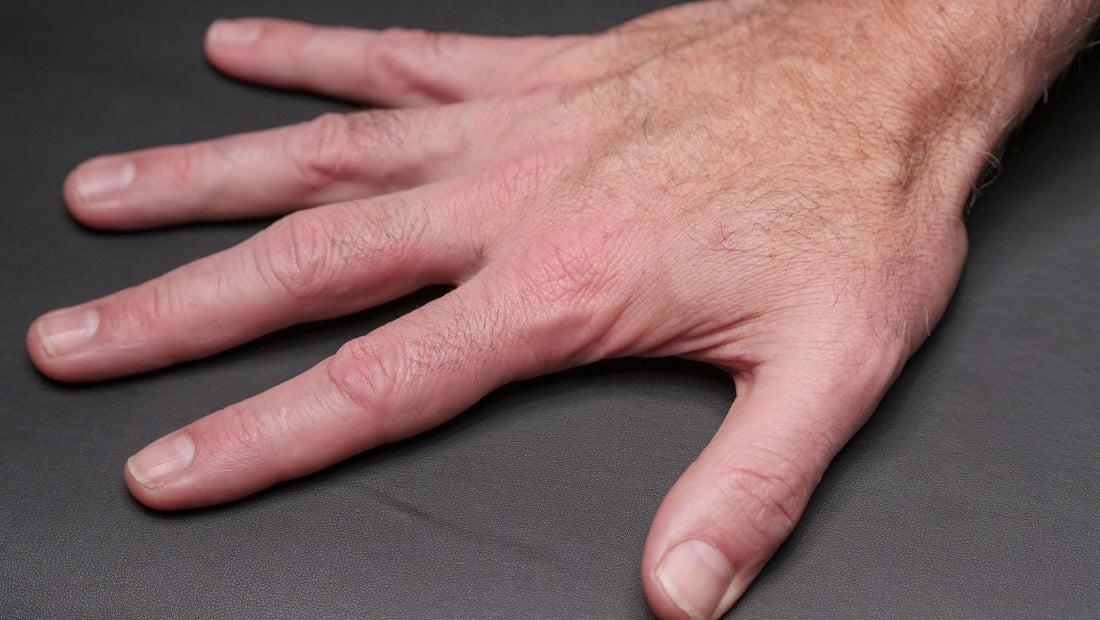 Testosteron bei Rheuma: Was die Daten zu Psoriasis und rheumatoider Arthritis zeigen