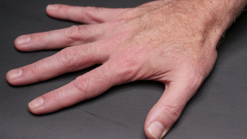 Testosteron bei Rheuma: Was die Daten zu Psoriasis und rheumatoider Arthritis zeigen